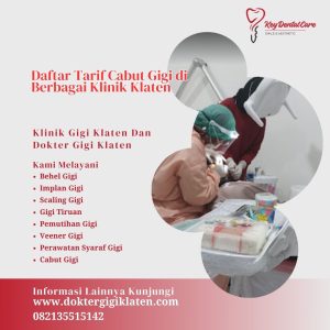 Daftar Tarif Cabut Gigi di Berbagai Klinik Klaten