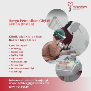 Harga Pemutihan Gigi di Klaten (Instan)