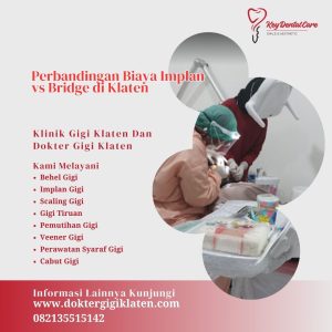 Perbandingan Biaya Implan vs Bridge di Klaten