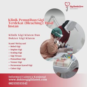 Klinik Pemutihan Gigi Terdekat (Bleaching): Hasil Instan