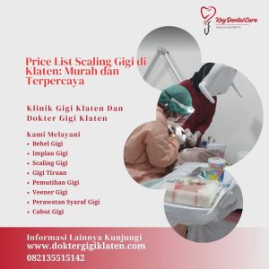 Price List Scaling Gigi di Klaten: Murah dan Terpercaya
