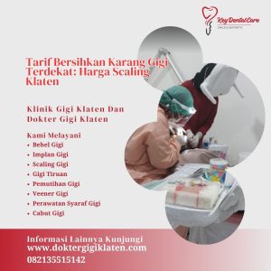 Tarif Bersihkan Karang Gigi Terdekat: Harga Scaling Klaten