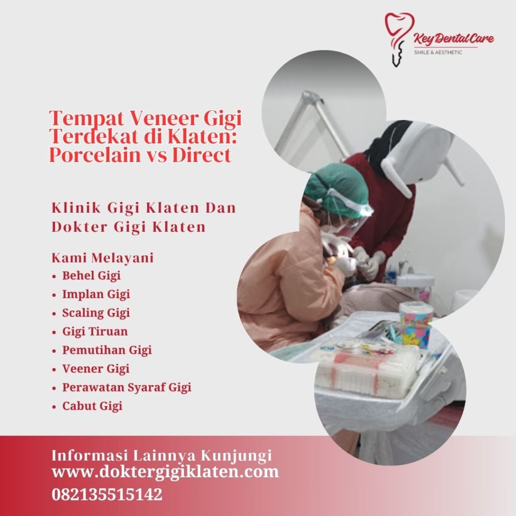 Tempat Veneer Gigi Terdekat di Klaten: Porcelain vs Direct