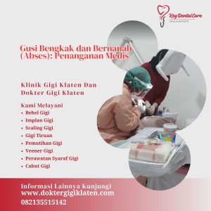 Gusi Bengkak dan Bernanah (Abses): Penanganan Medis
