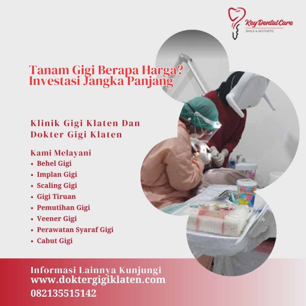 Tanam Gigi Berapa Harga? Investasi Jangka Panjang